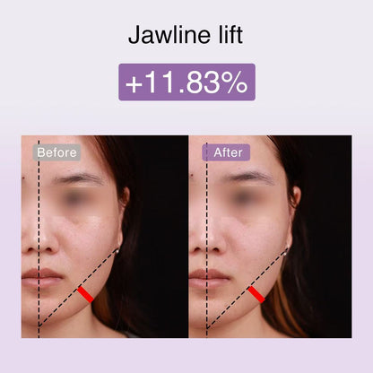 DermRays FusionGlow Multi-Functional Microcurrent Facial Toning Device