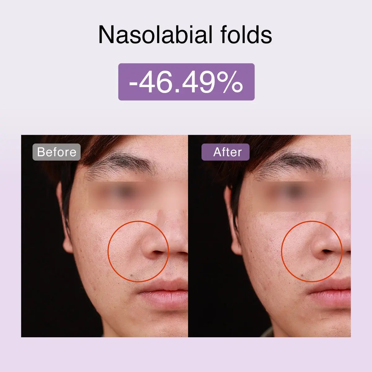 DermRays FusionGlow Multi-Functional Microcurrent Facial Toning Device
