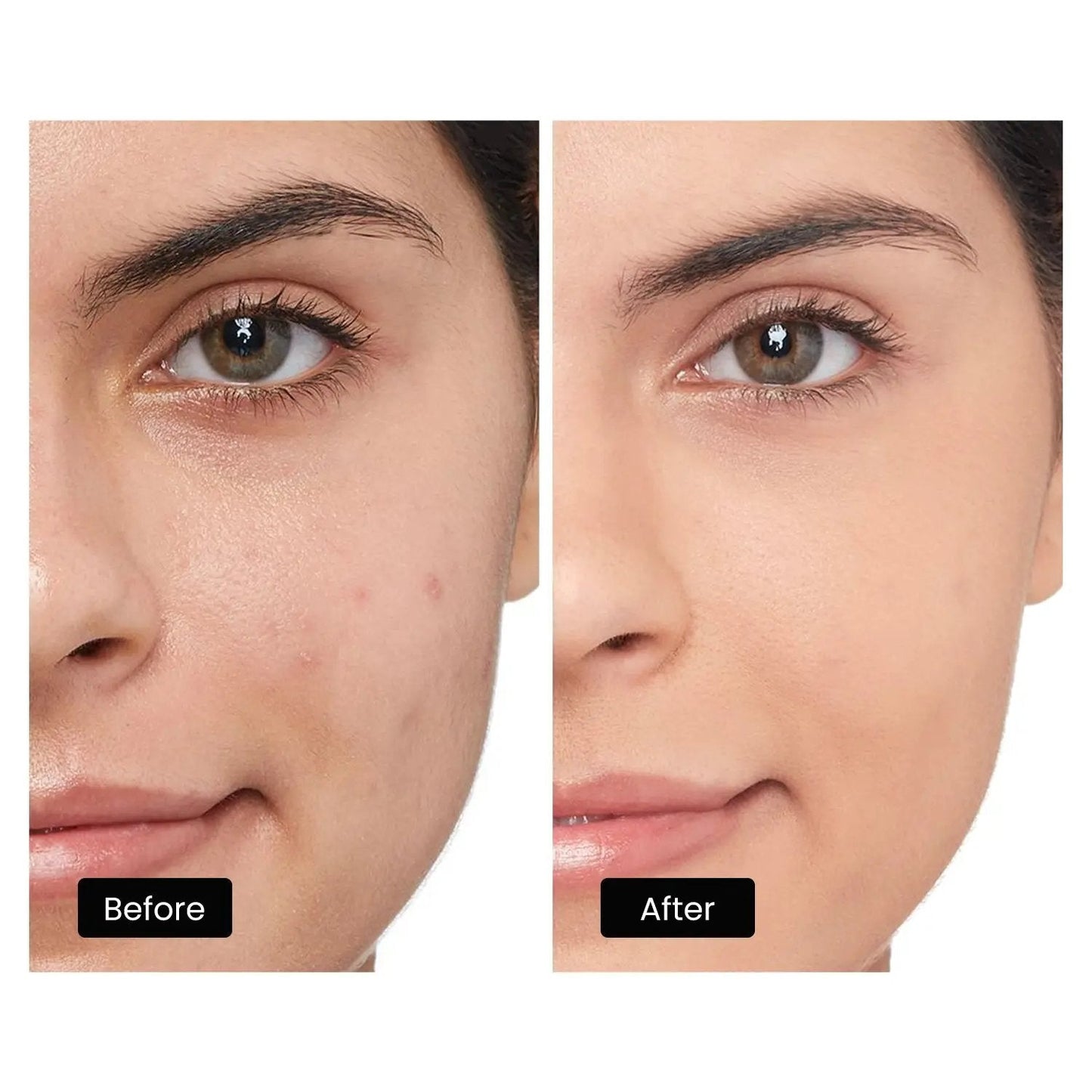 DermRays LED Light Therapy Mask For Face, Neck and Décolletage, Revitalize & Renew Your Skin