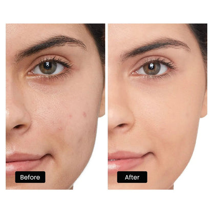 DermRays LED Light Therapy Mask For Face, Neck and Décolletage, Revitalize & Renew Your Skin