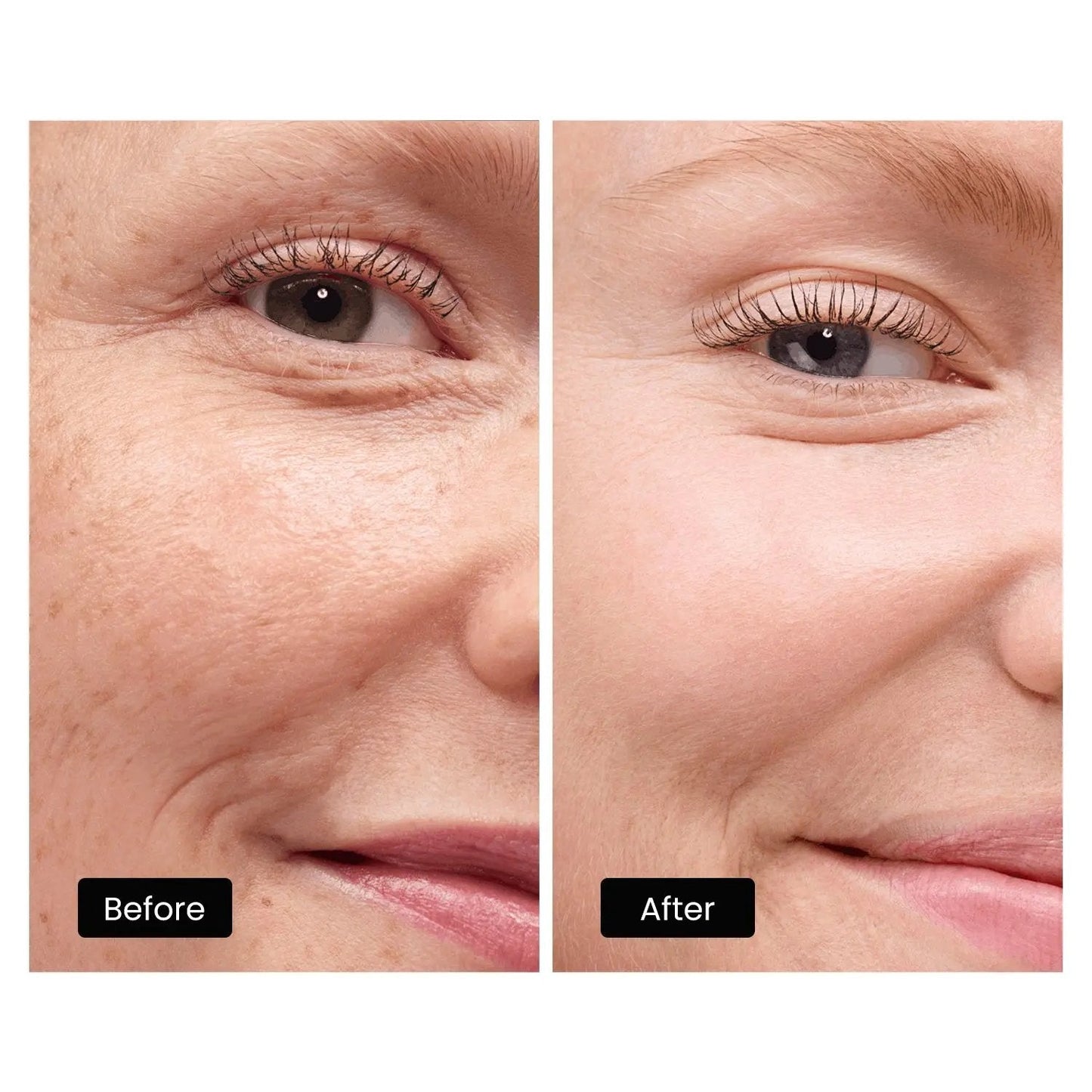 DermRays LED Light Therapy Mask For Face, Neck and Décolletage, Revitalize & Renew Your Skin