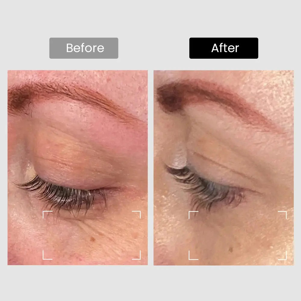 DermRays Revive Skincare Laser for Anti-Aging, Glow Like Never Before