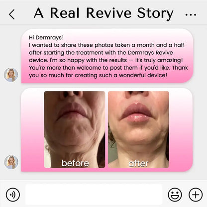 DermRays Revive Skincare Laser for Anti-Aging, Glow Like Never Before